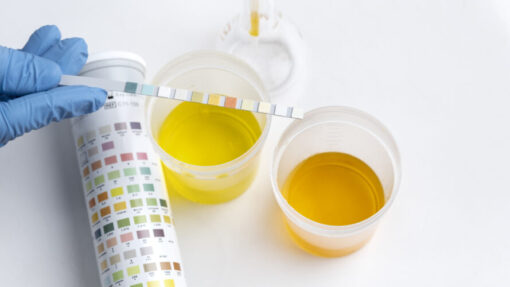 Testing a urine sample for tampering using an adulteration dip strip and color comparison chart
