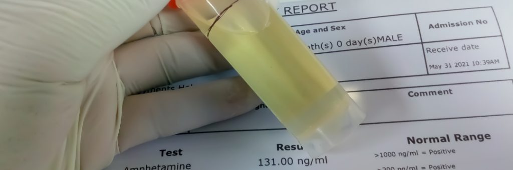 The Escalating Demand for Rapid Drug Testing in Policing: Enhanced Solutions for Law Enforcement