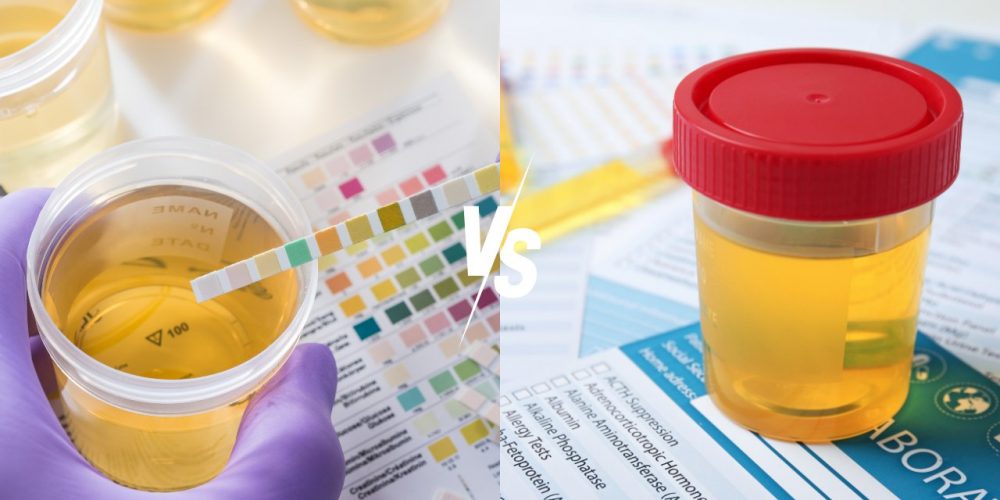 Image of a urine dip card being tested and a urine cup being tested