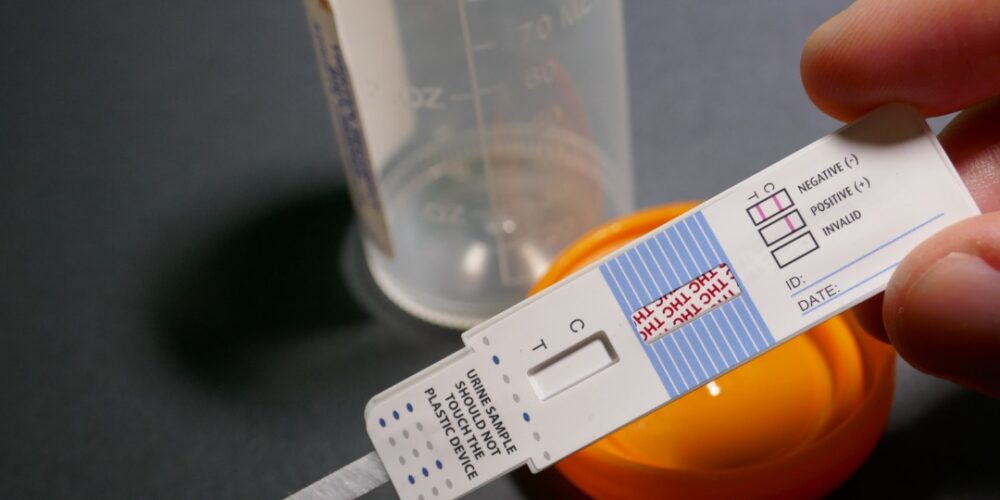 Drug detection windows