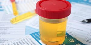 urine drug test