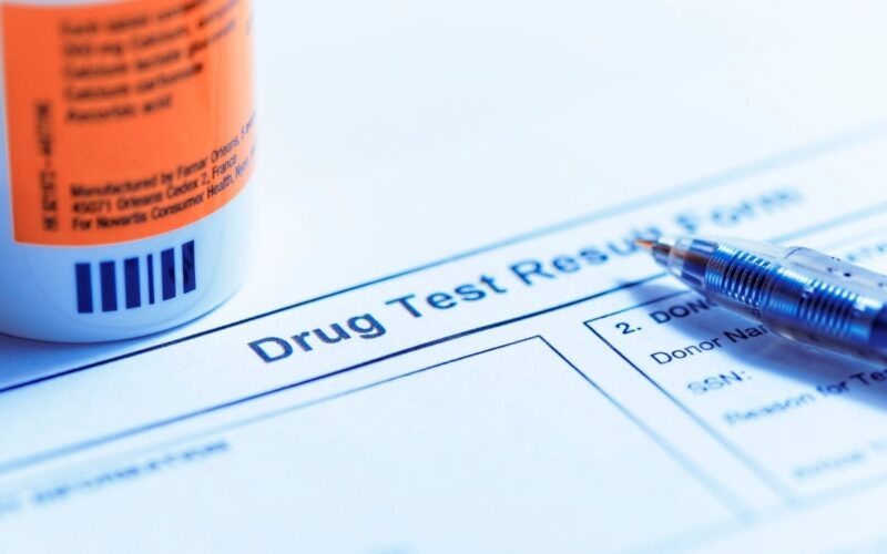 Drug Test Results Form