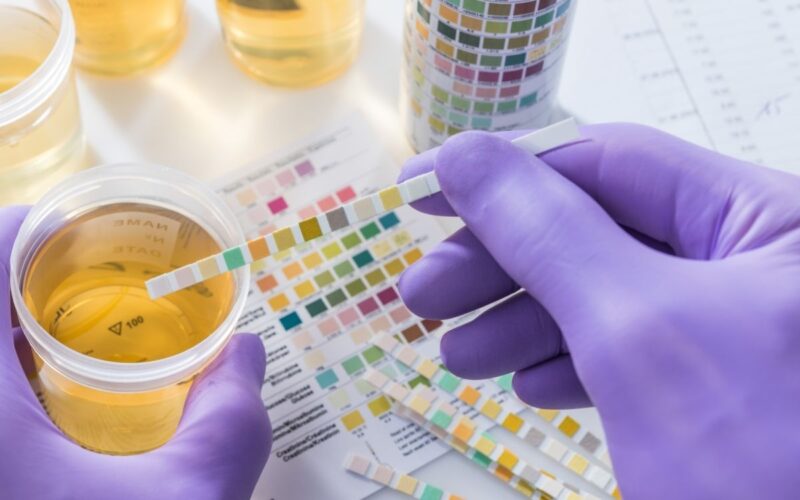 DOT vs Non-DOT Drug Testing: What Employers MUST Know (2026 Compliance & Buying Guide)