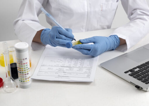 professional documenting urine sample analysis during drug screening