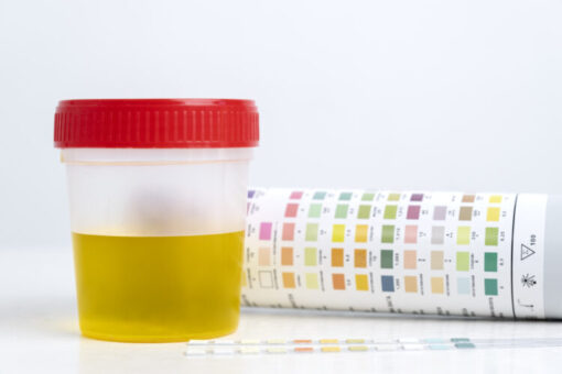 Urine drug test sample cup with color comparison chart