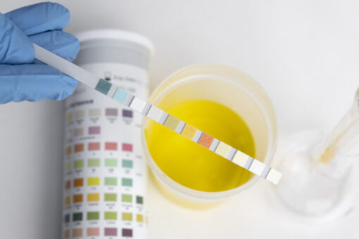 Close-up of urine sample analysis