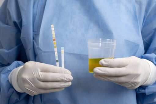 FDA cleared vs approved: Urine drug test kit with specimen cup and detection strips