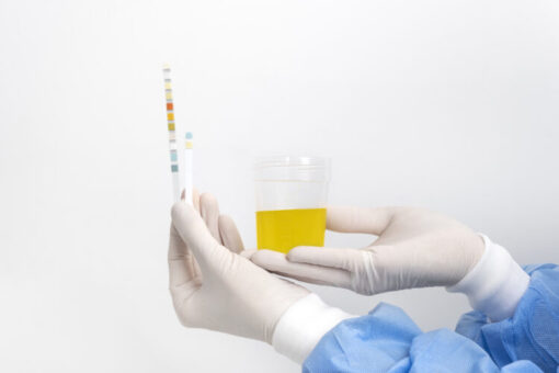 Gloved hand holding a urine sample cup