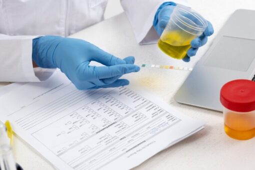 medical technician conducting a rapid urine drug test screening over compliance paperwork