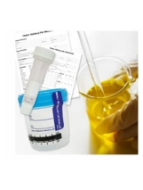 80 Hour - EtG Alcohol Lab Collection Test