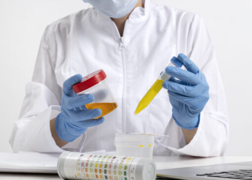 professional holding urine sample containers for alcohol testing