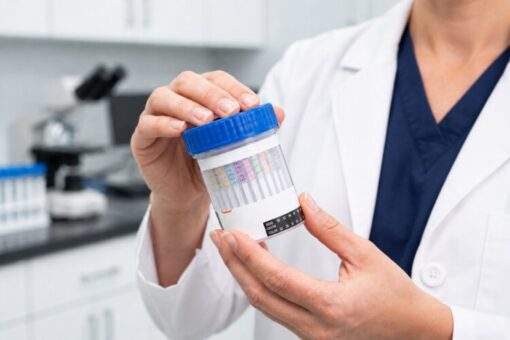 Laboratory technician checking the built-in temperature and test strips on a urine screening cup