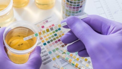 Dip test strip reading for urine specimen validity checks
